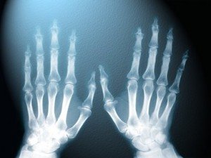 Top 10 Medical Breakthroughs - X - Rays